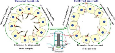 The Role of Primary Cilia in Thyroid Cancer: From Basic Research to Clinical Applications